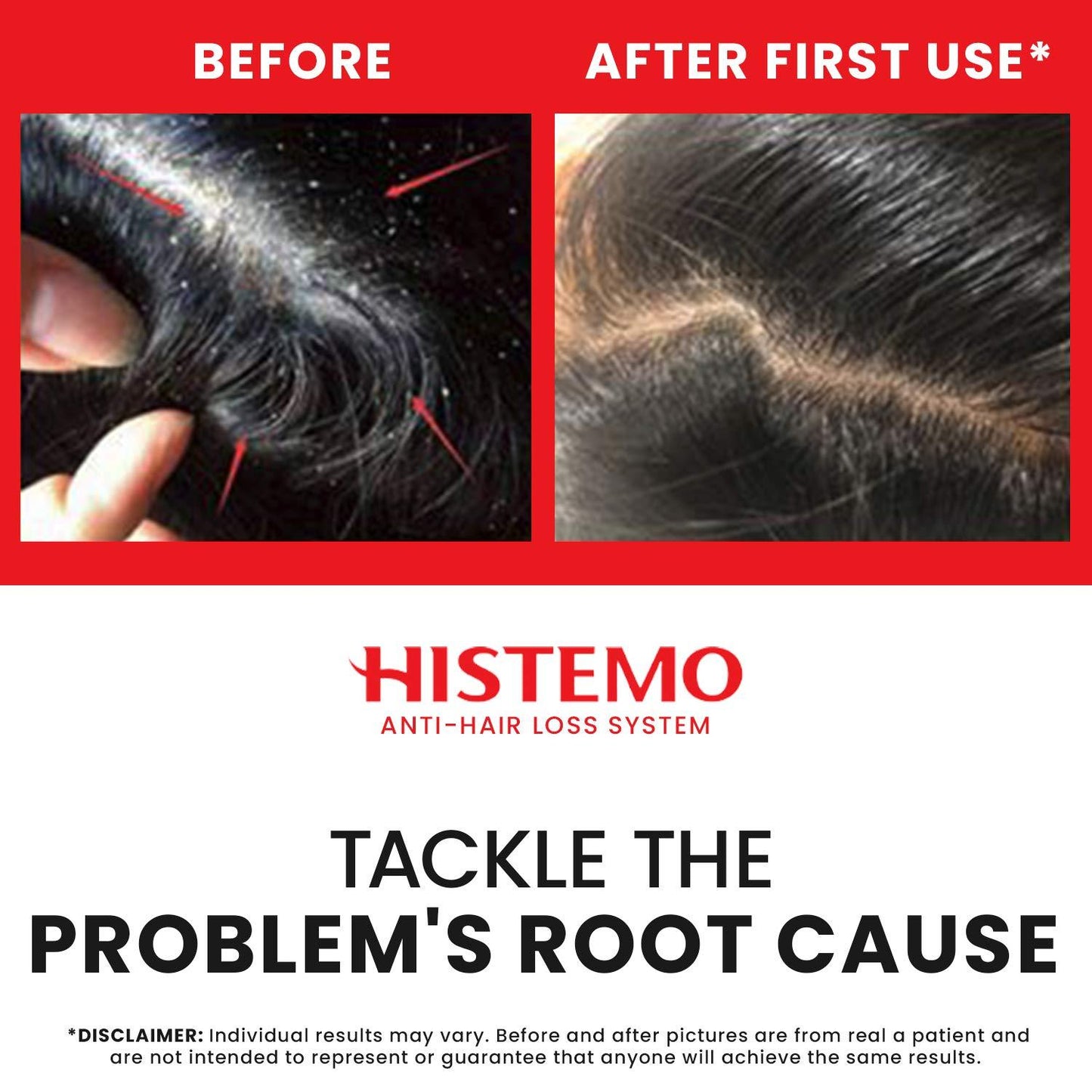 Histemo ION-TO S Scalp Cleanser